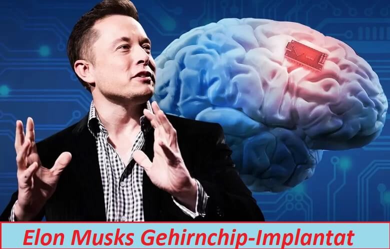 Elon Musks Gehirnchip-Implantat